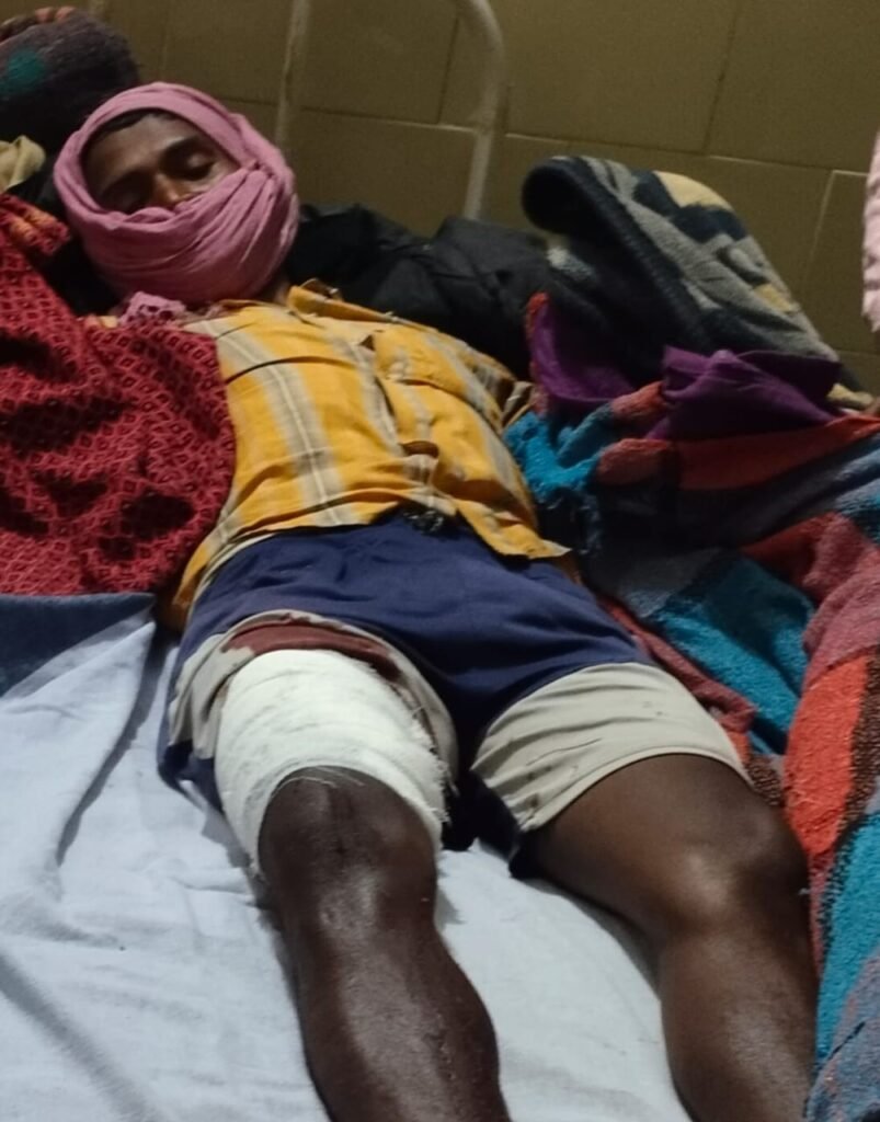 भालू व भगवानदीन के बीच द्वंद,  जान बचाकर भागा भालू