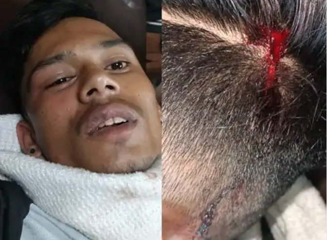 दुकान संचालक पर पिस्टल की बट से हमला