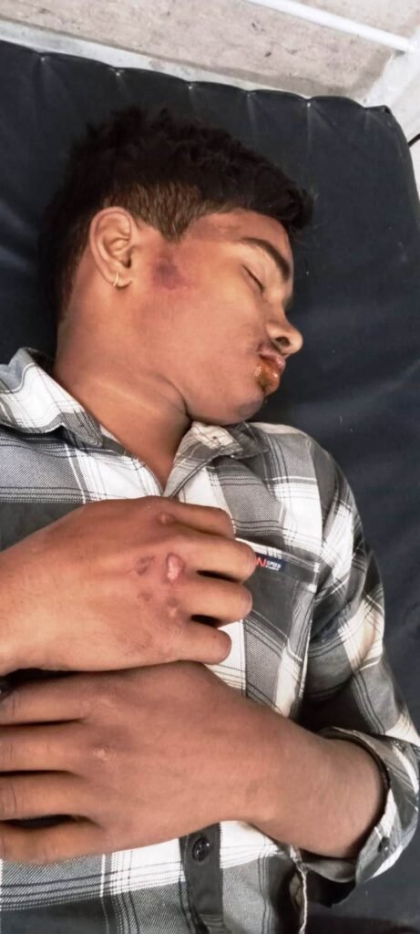 फिर दिखा रफ्तार का कहर, देर शाम मोरवा में घटी सड़क दुर्घटना में एक की मौत, तीन घायल