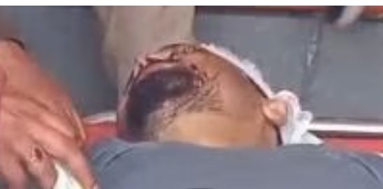 जमीनी विवाद में प्रॉपर्टी डीलर पर दिनदहाड़े चलाईं गोलियां