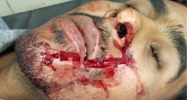 बारातियों में डीजे पर डांस करने के दौरान चाकू बाजी