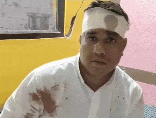 घर में घुसे चोरों का परिवार पर हमला