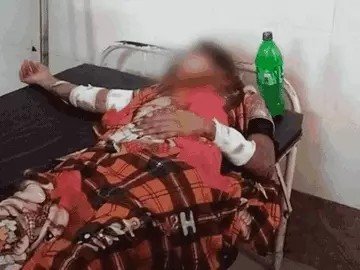 क्रूर घटना : पत्नी के प्राइवेट पार्ट में हंसिया मारा, नाक काटी