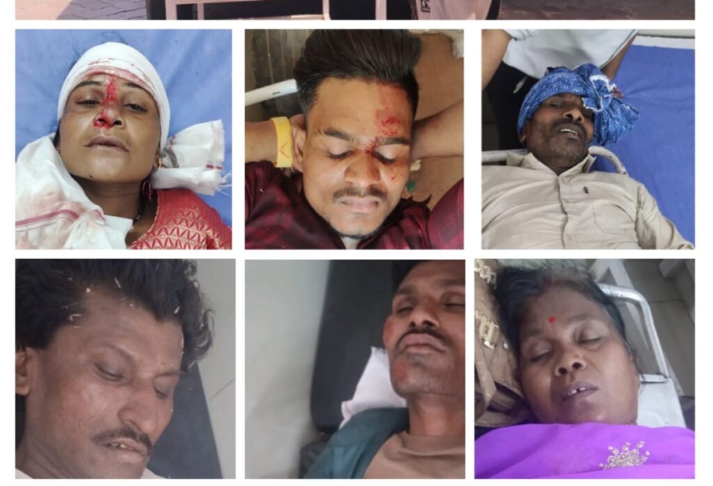 इटारसी में तीन बाइकों की भिड़ंत में सात लोग घायल, तीन के पैर टूटे  