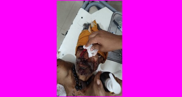 घर कब्जाने की नियत से अधेड़ पर कुल्हाड़ी से हमला