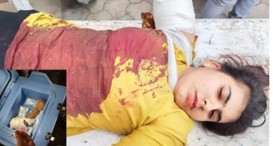 बस-हाईवा की टक्कर में युवती का कटा हाथ 