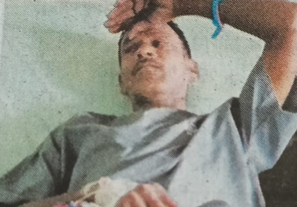 हाईड्रा मशीन की चपेट में आने से मजदूर घायल