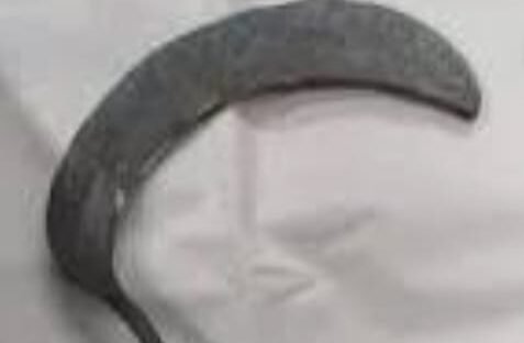 साले पर जीजा ने हंसिया से किया जानलेवा हमला