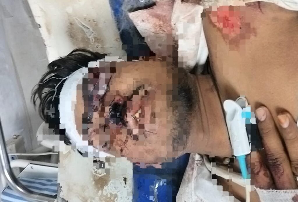 सड़क दुर्घटना में बाइक सवार की मौत