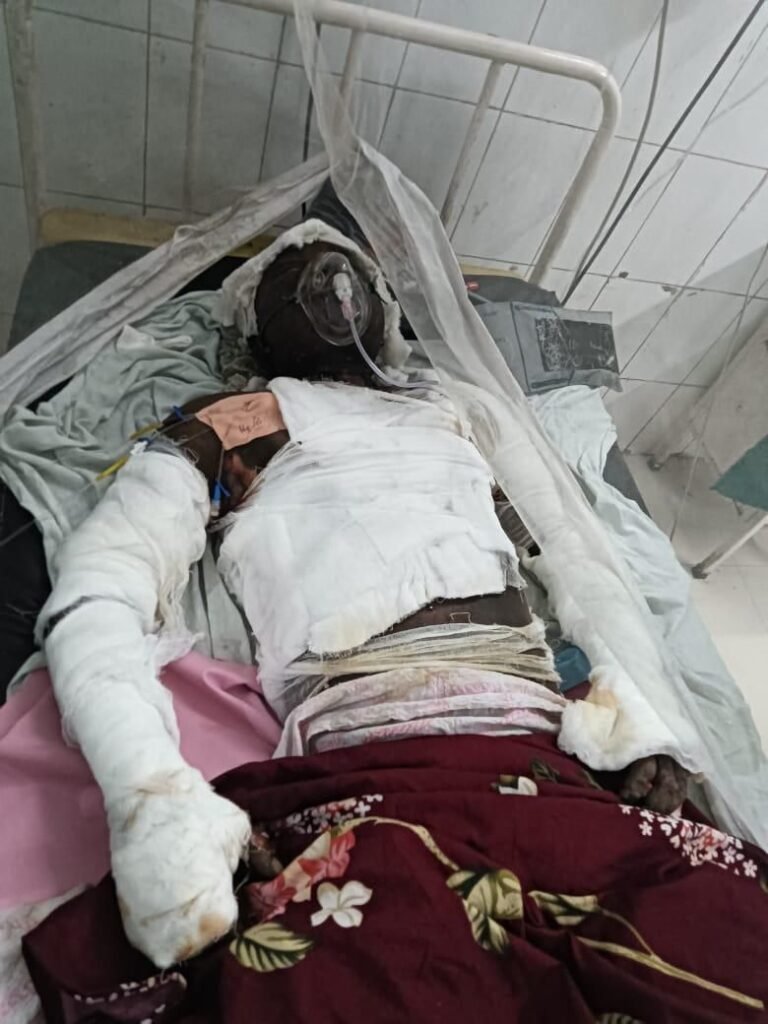 युवक ने ख़ुद को आग लगाई