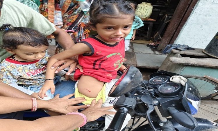 बच्चों को कुत्तों ने घेरा, झुंड बनाकर एक साथ किया हमला, तीन मासूम जख्मी