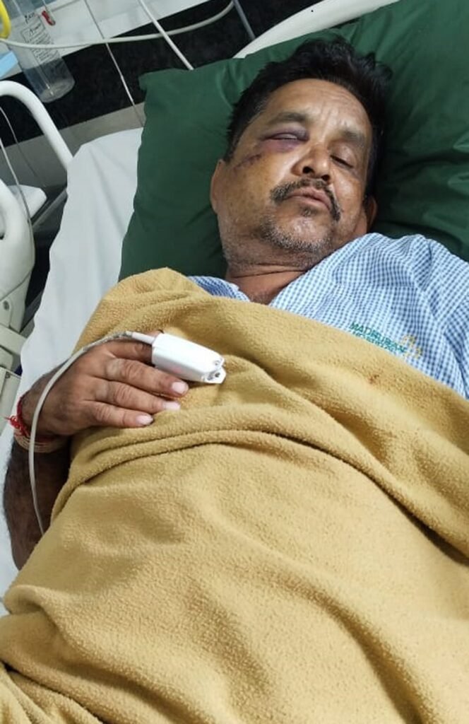 भेरूंदा से नर्मदापुरम जा रही बस पर पथराव,एक युवक घायल