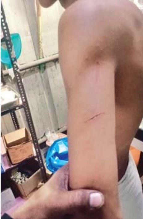 आपसी विवाद ने लिया हिंसक रूप, युवक पर चाकू से हमला