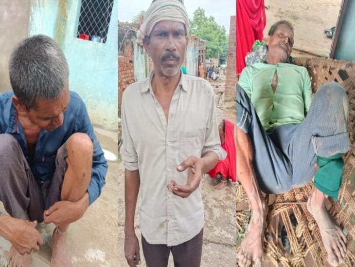 डीपी से तार जोड़ने को लेकर दो पक्षों में चली लाठिया, घर में घुसकर पीटा