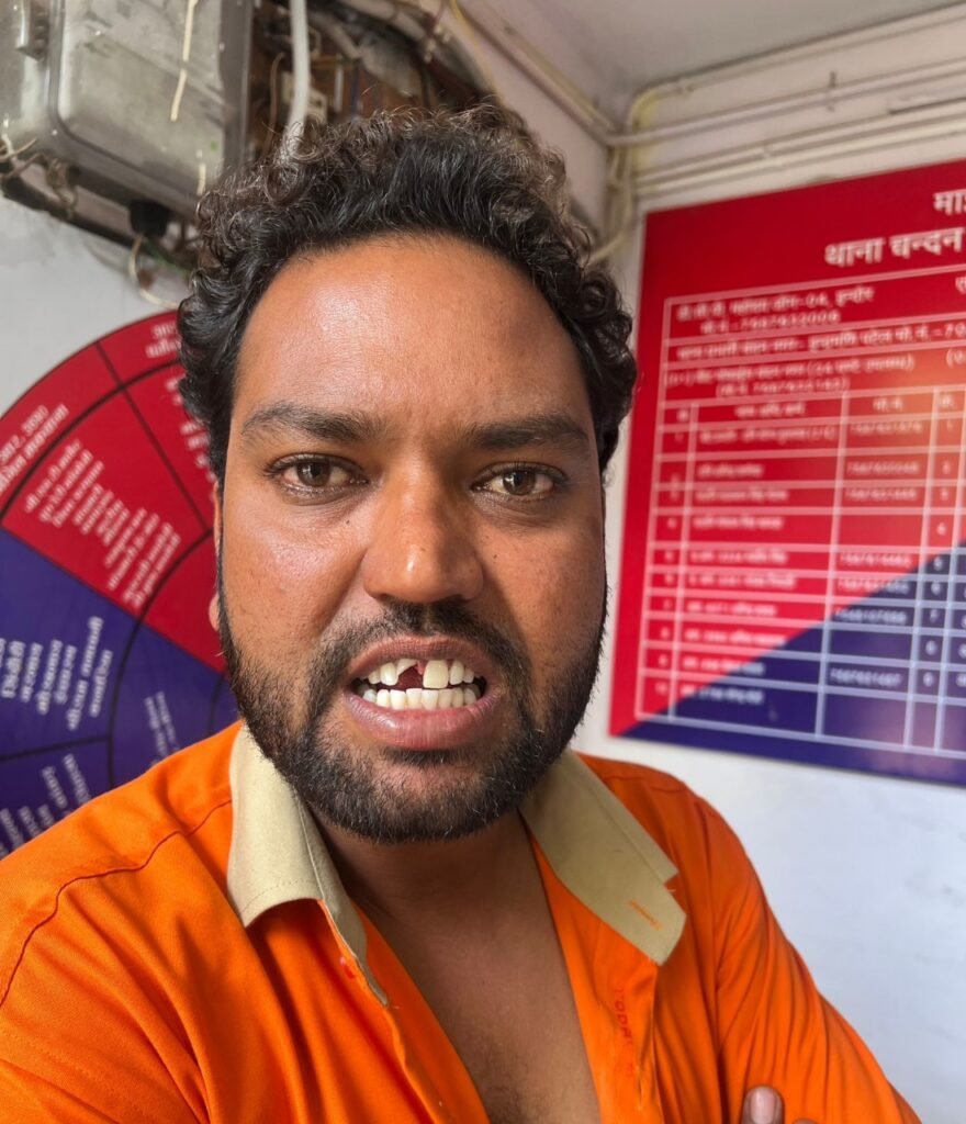 बिना हेलमेट पेट्रोल देने से रोका तो कर दिया जानलेवा हमला