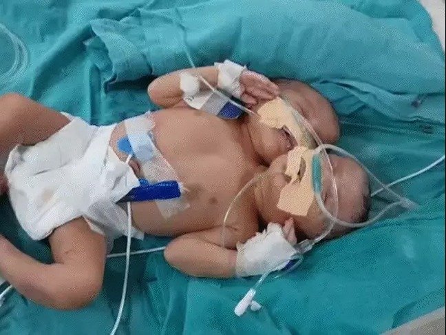 सांसों के सहारे चल रही थी जिंदगी… परिजन इलाज अधूरा छोड़ गांव लौटे