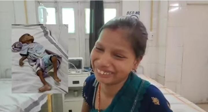 कुपोषण से एक साल की लाड़ो की मौत, सीएमएचओ ने कहा, बच्ची को लेकर घर भाग गए थे स्वजन