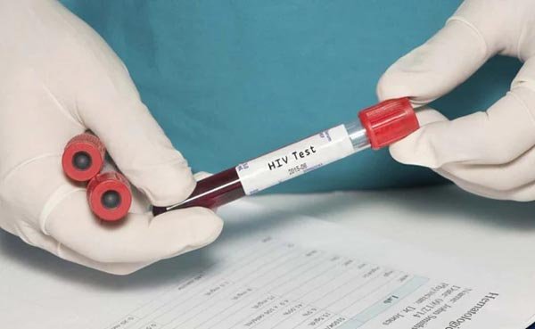 मिज़ोरम में सात महीनों में एचआईवी से संबंधित 259 मौतें दर्ज, लगभग 20,000 लोग वायरस से ग्रसित
