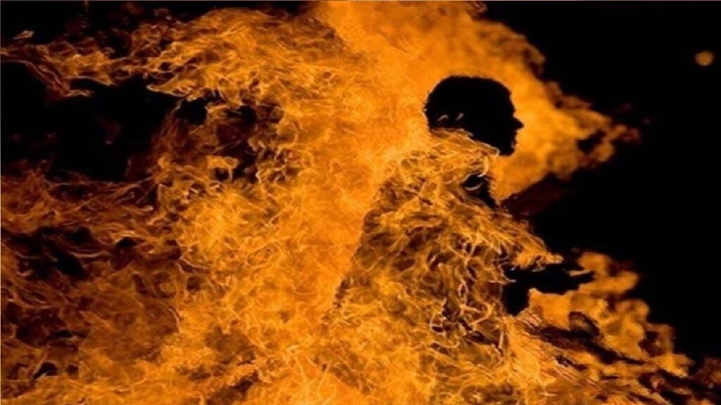 घरेलू विवाद के बाद युवक ने लगाई आग, 70 % झुलसा