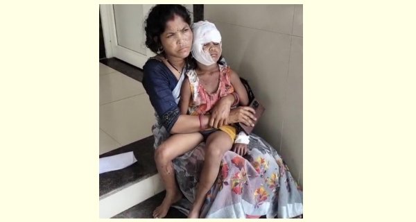 स्ट्रीट डॉग्स ने मासूम पर किया अटैक, नोंचा