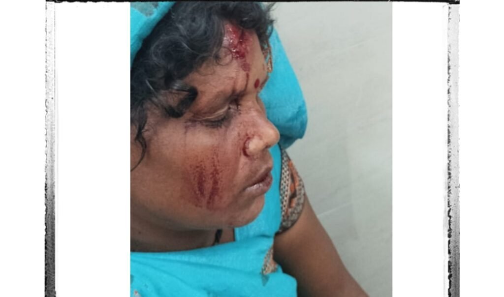 जमीनी विवाद में महिला पर हमला, गंभीर रूप से हुई घायल 