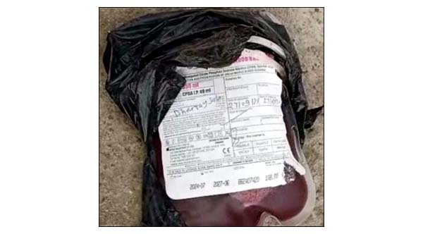 डबरा में कचरे के ढ़ेर में मिला कई यूनिट ब्लड, नोंचते दिखे स्ट्रीट डॉग्स