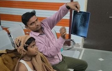 नोटबुक निकालने की सज़ा टीचर ने 7वीं के छात्र को इतना पीटा कि टूट गई कंधे की हड्डी