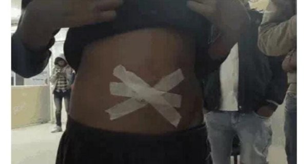 भिंड में 10 राउंड फायरिंग, एक किशोर की मौत, दो घायल