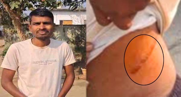 साहूकारी का खौफनाक चेहरा: 1 लाख का कर्ज हुआ 48 लाख, किसान को कंबोडिया में बेचनी पड़ी किडनी