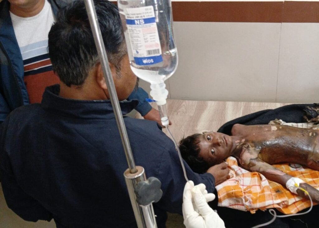 कटी पतंग को पकड़ने के दौरान करंट लगने से बालक झुलसा