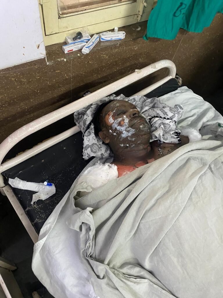 पटाखा व्यापारी के घर में ब्लास्ट से पूरे नगर में हडक़ंप, फायरमैन सहित चार झुलसे