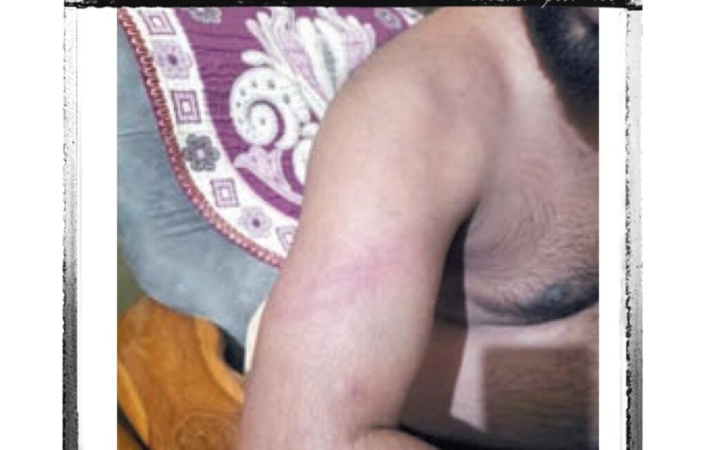 ई रिक्शा चालकों की गुंडई: युवक को बेरहमी से पीटा, पिकअप में की तोड़फोड़ 