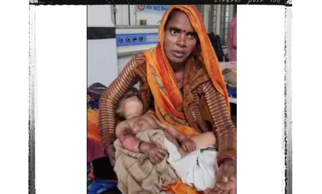 बमनीघाट गांव में दर्दनाक हादसा डेढ़ माह का मासूम खौलती कढ़ाई में गिरा