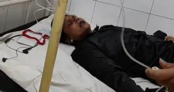 बागेश्वर बाबा की कथा में महिला बाउंसर को करंट लगा, हालत गंभीर