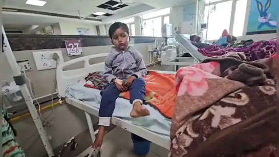 आवारा कुत्ते ने बच्चे को नोंचा, बड़ी मुश्किल से ऑपरेशन कर पाए डॉक्टर; चेहरे और पैरों में हुए घाव