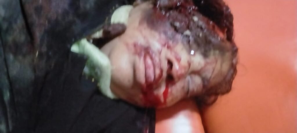 रेस्टोरेंट के पास मिला बुजुर्ग महिला का शव, शरीर पर मिले चोट के निशान