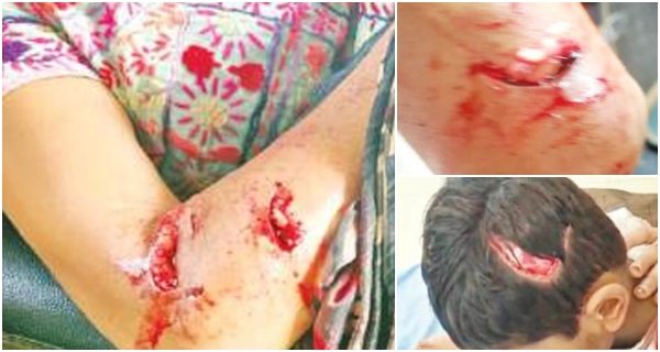 दो दिनों में दो श्वानों का आतंक, गुलमर्ग परिसर में 7 लोगों को बनाया शिकार