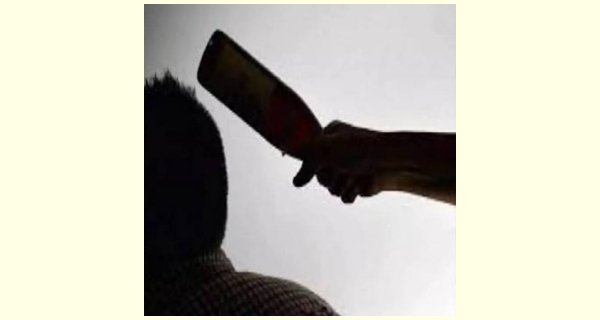 चाचा ने भतीजे पर हमला कर फोड़ा सिर