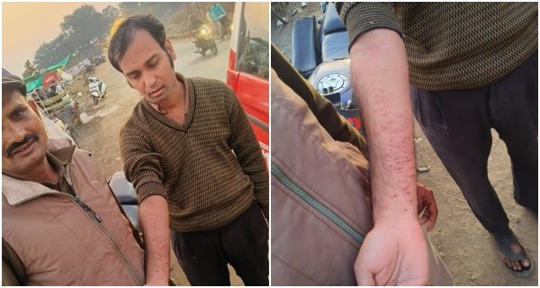 हाथ में कैंची से वार कर धुआंधार में कूदने पहुंचा युवक