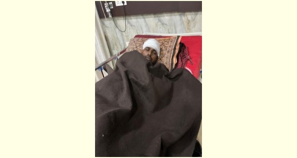 कढ़ाई का तेल उड़ेला, झारा से किया हमला, जीजा-साले घायल