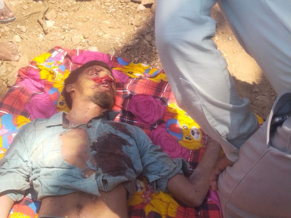 हाई टेंशन बिजली टॉवर से गिरने से किशोर की मौत