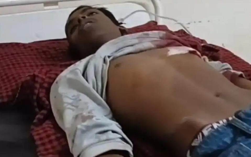 त्रिकोणीय प्रेम प्रसंग में किशोर की सरेराह चाकू मारकर हत्या