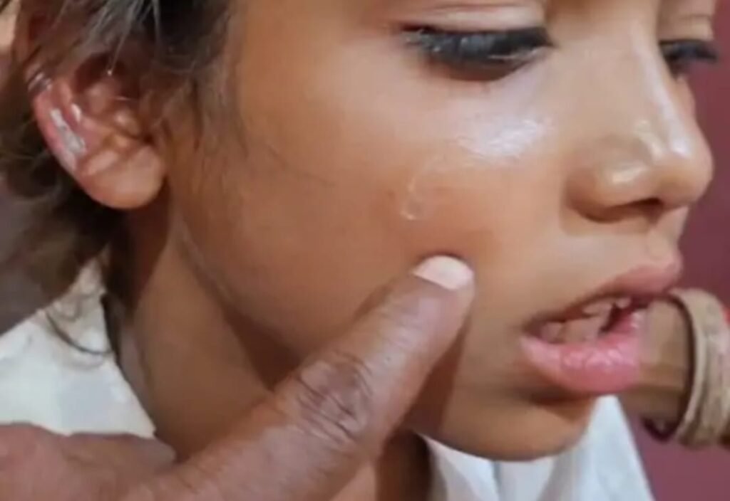 जवारे विसर्जन के दौरान मधुमक्खियों का हमला, 10 बच्चों समेत 30 लोग घायल