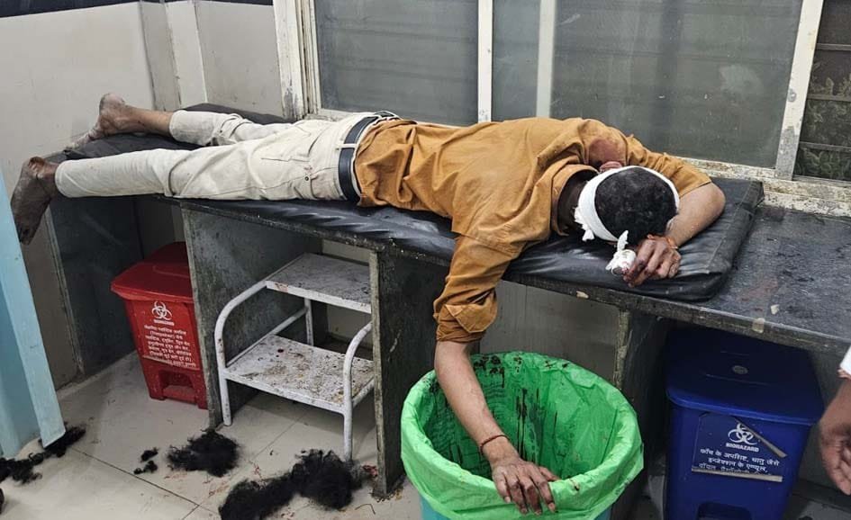 मामूली विवाद ने लिया हिंसक रूप: 30 रुपये के लेनदेन पर पत्थरबाजी और दराते से हमला, कई घायल