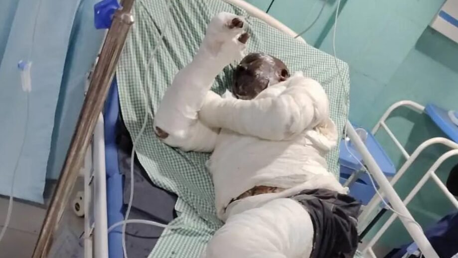 आंगनबाड़ी कार्यकर्ता के पति ने इलाज के दौरान दम तोड़ा