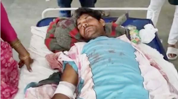 मोरवा में मूकबधिर युवक की बेरहमी से मारपीट, अस्पताल में भर्ती