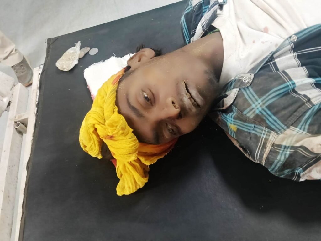 सड़क दुर्घटना में एक की मौत, एक युवक घायल 