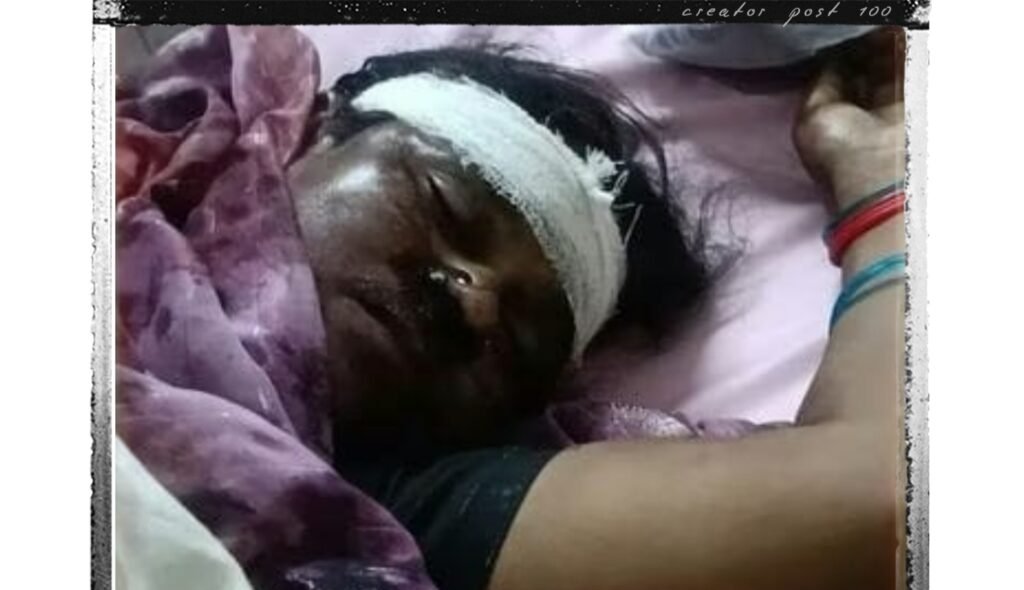 सड़क किनारे खड़ी महिला को पिकअप ने मारी टक्कर, मौके पर मौत