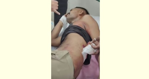 रायसेन जेल से फरार होने के  प्रयास में कैदी ने जेल प्रहरी को मारी गोली